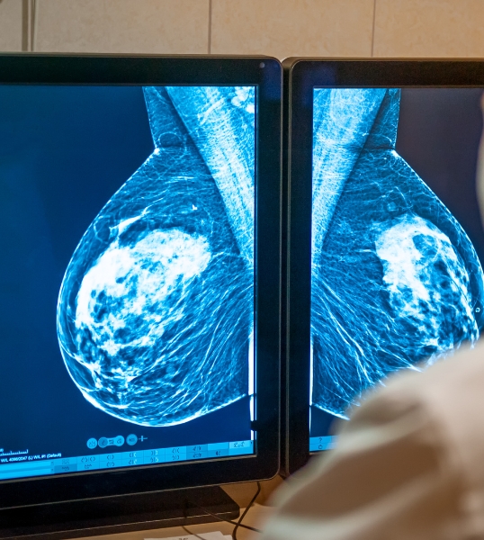 Chirurgie gynécologique et mammaire