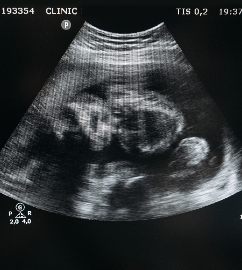 gynécologue obstétricien à Oujda